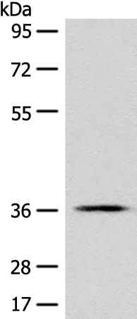 GPR55 Antibody