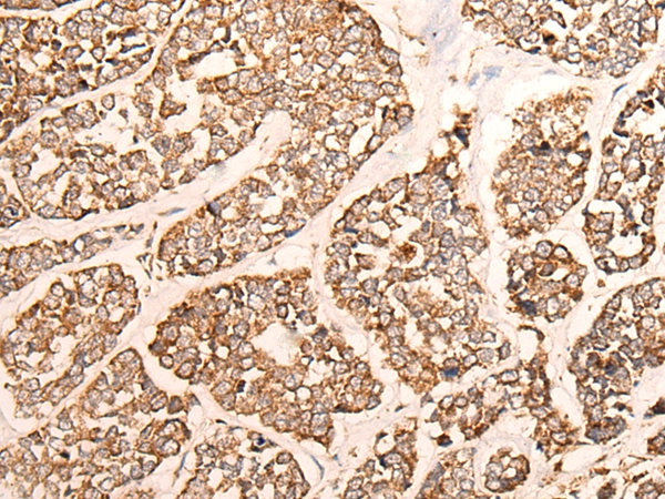 GRIA4 Antibody