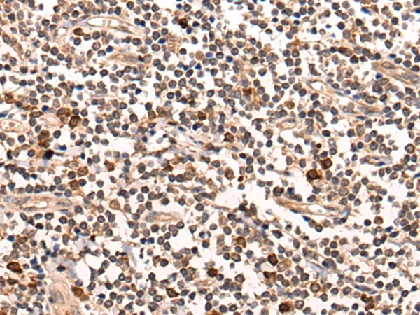 GRM5 Antibody