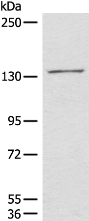 HIPK2 Antibody