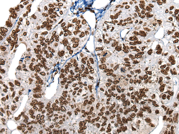 HNRNPR Antibody