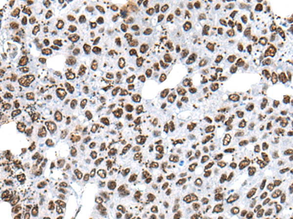 HNRNPR Antibody