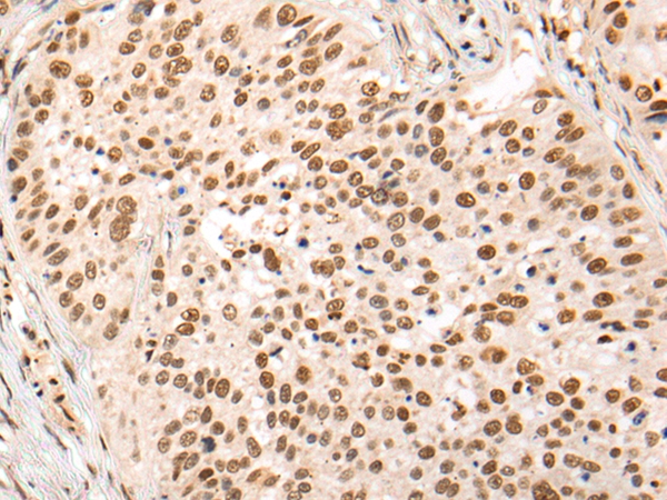 HOXA7 Antibody