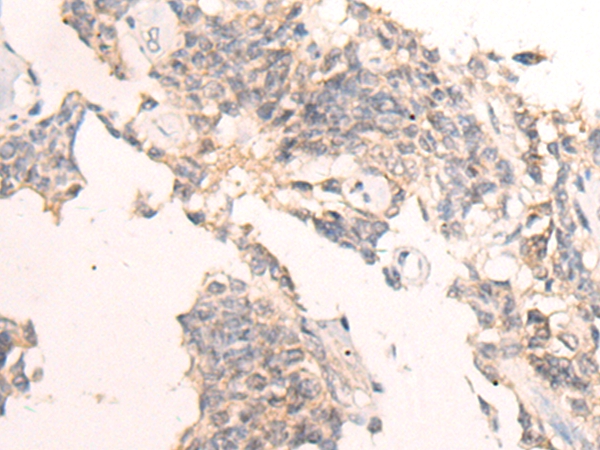 IBA57 Antibody