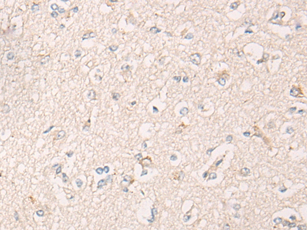 IBA57 Antibody