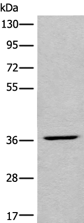 LDAH Antibody