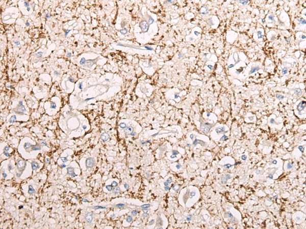 LDLR Antibody