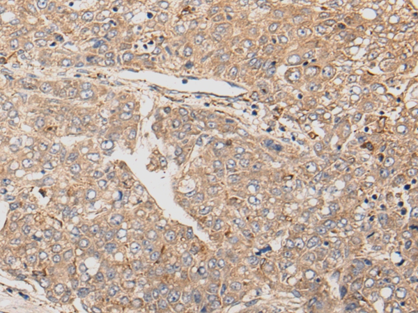 LPAR6 Antibody