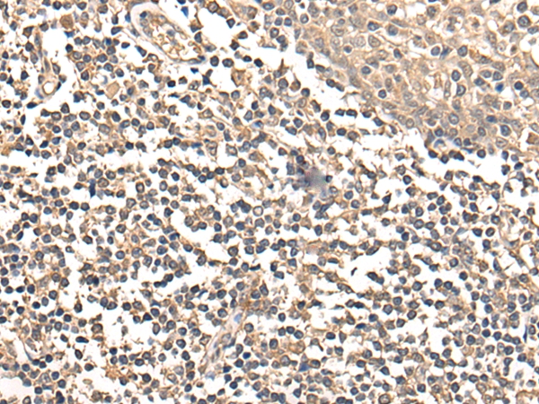 LPL Antibody