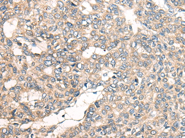 LRP1B Antibody