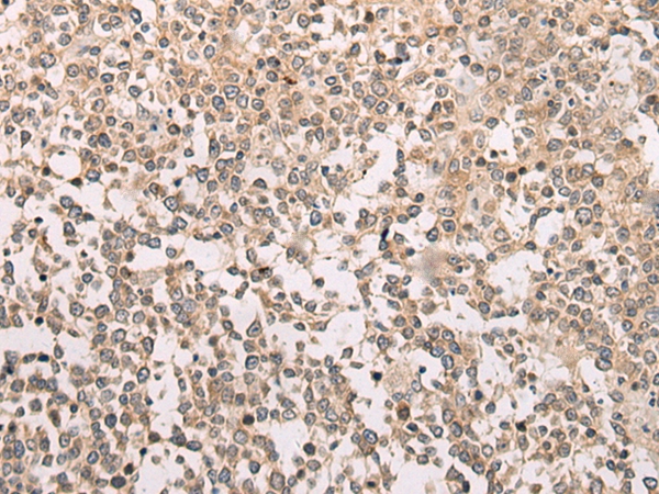 M1AP Antibody