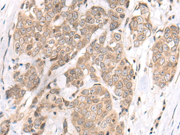 M1AP Antibody