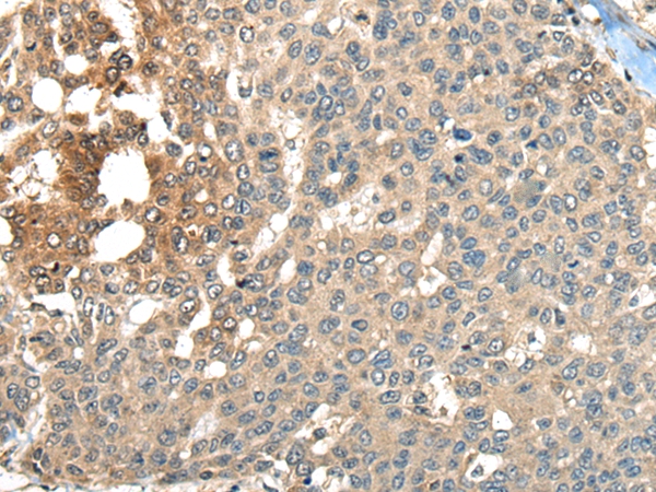 MAPK4 Antibody