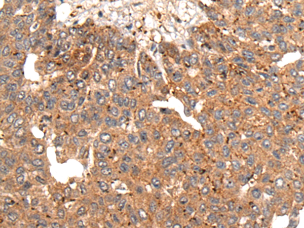 MB21D1 Antibody