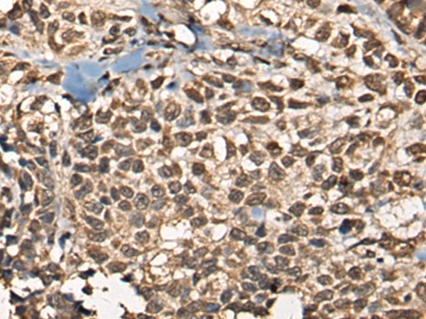 MBD2 Antibody