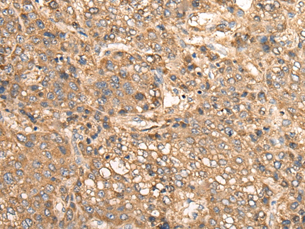 MEIOB Antibody