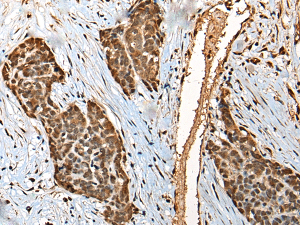 MICU1 Antibody