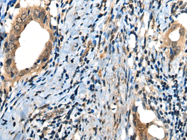 MICU1 Antibody