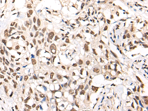 MTA2 Antibody