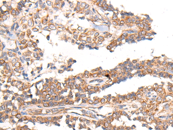 MTNR1B Antibody