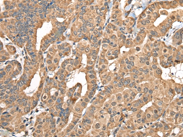 NADK2 Antibody