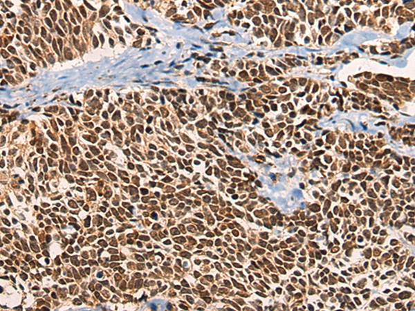 NCBP1 Antibody