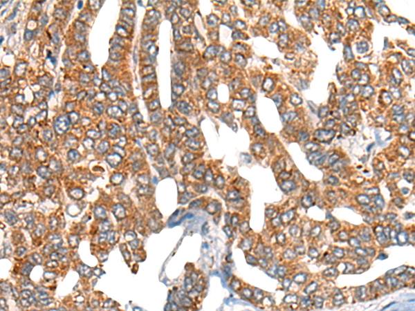 NCBP1 Antibody