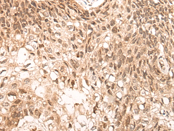 NCOA6 Antibody