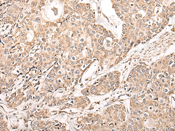 NDUFB11 Antibody