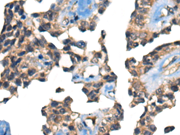 NELFB Antibody