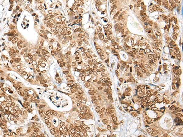 NKX3-2 Antibody