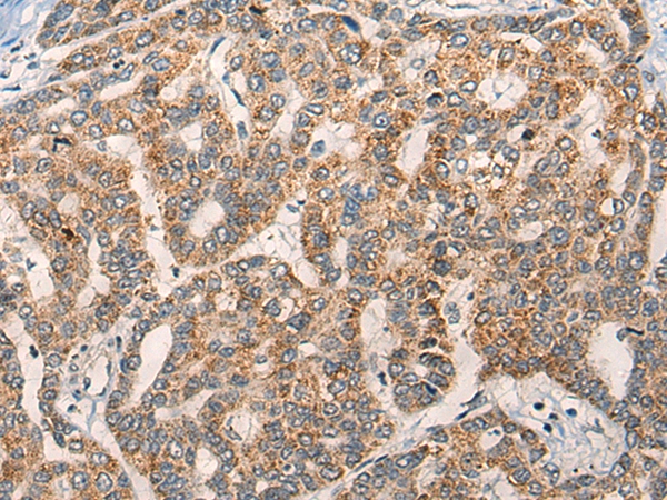 NLGN1 Antibody