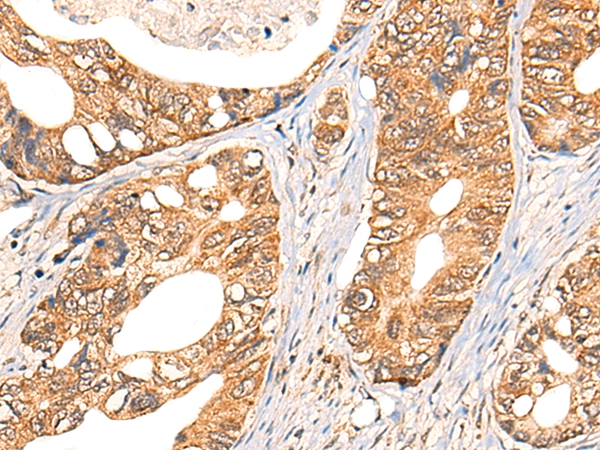 NOL8 Antibody