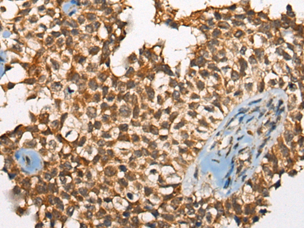 ODF2 Antibody