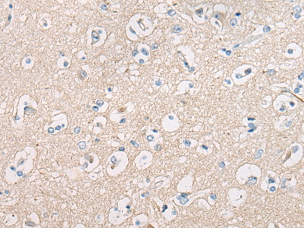 ORAOV1 Antibody