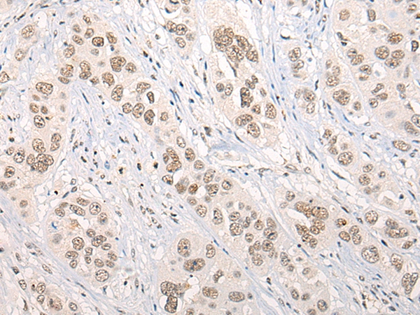 PRPF8 Antibody