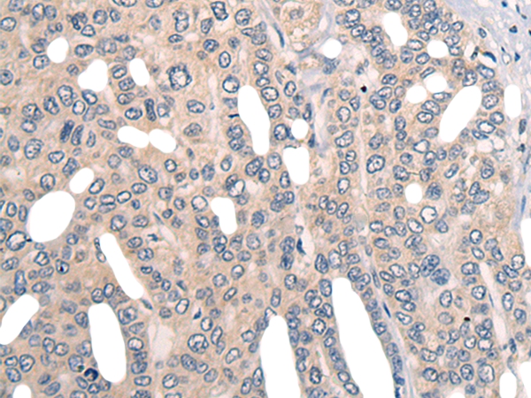 PRPF8 Antibody