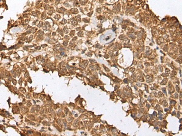 RBL2 Antibody