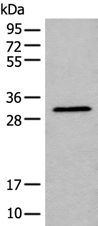 RCAN3 Antibody