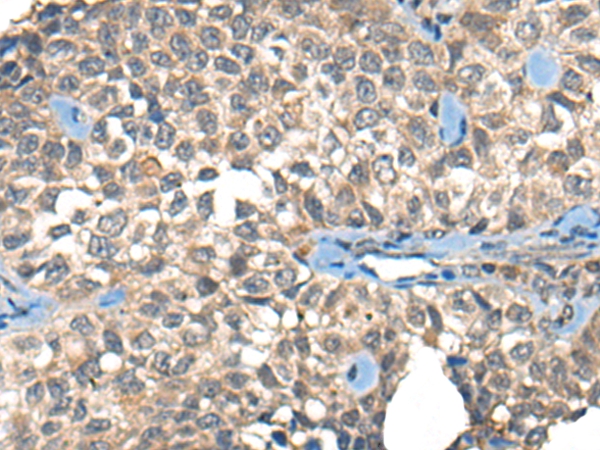 RCOR1 Antibody