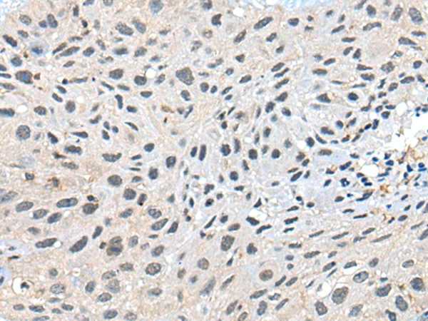 RCOR1 Antibody