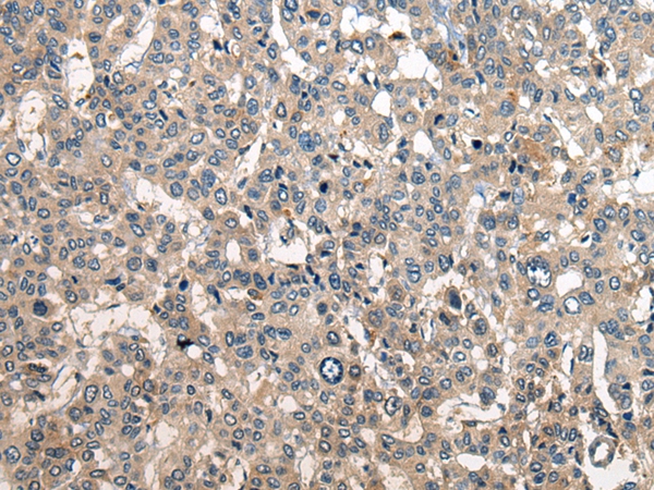 RCOR2 Antibody