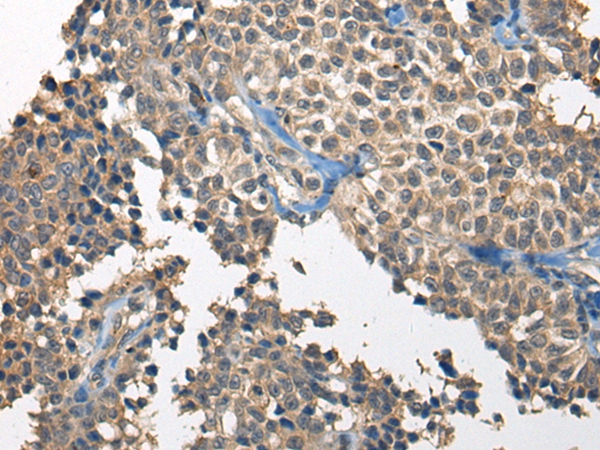 RCOR2 Antibody