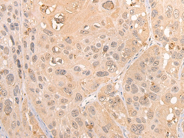 RCOR3 Antibody