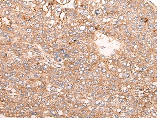 SIGLECL1 Antibody