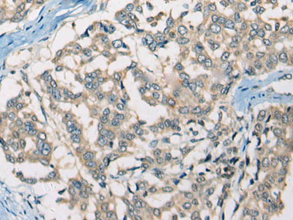 SLC5A3  Antibody