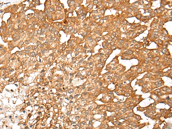 SLC7A1 Antibody