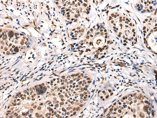 USP6NL Antibody