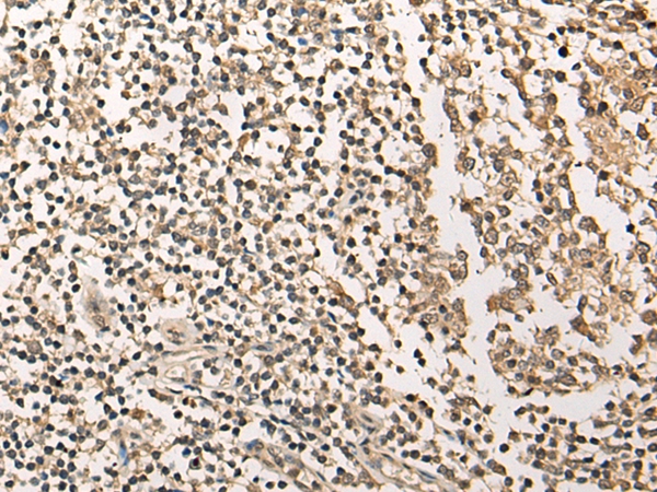 UTP11 Antibody