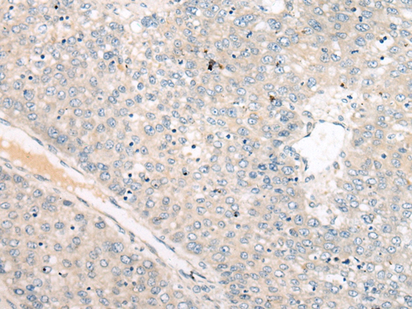 WBP1 Antibody